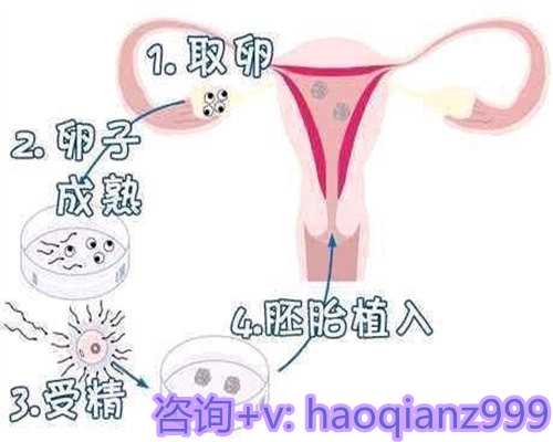 月经不调会影响试管婴儿成功率吗？医生说出秘密